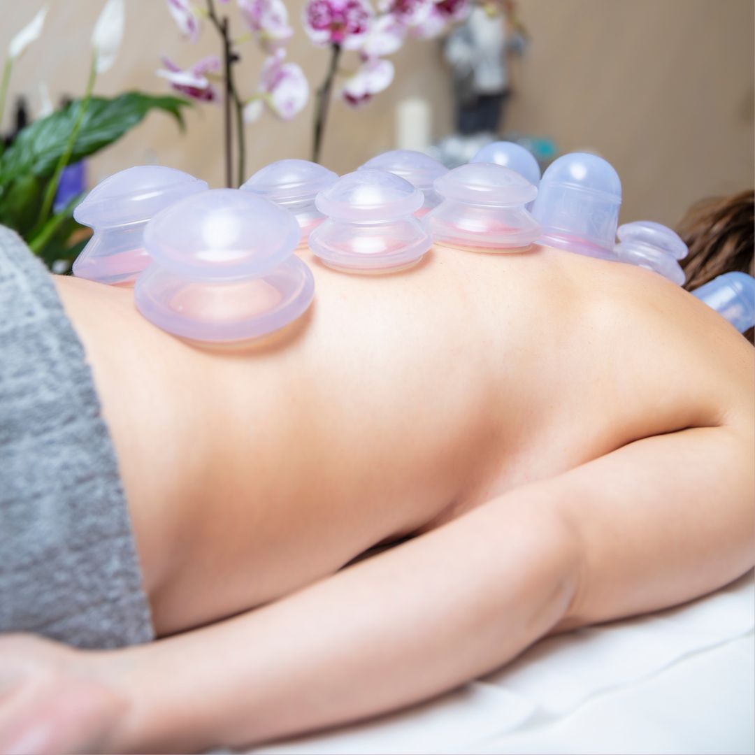 cupping